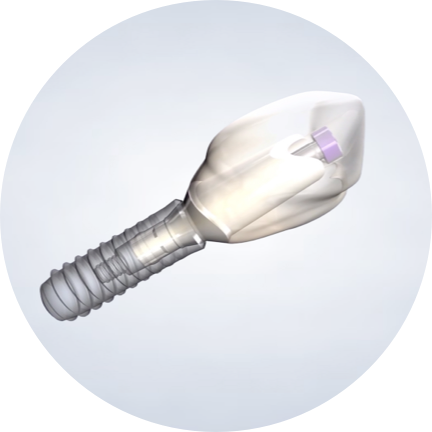 dental implants in aliso viejo, CA